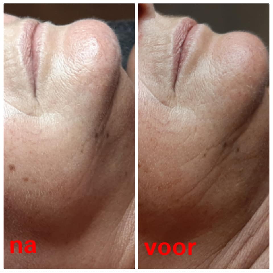 Deze afbeelding heeft een leeg alt-atribuut; de bestandsnaam is 104209244_146470453645907_2817350004649518079_n.jpg